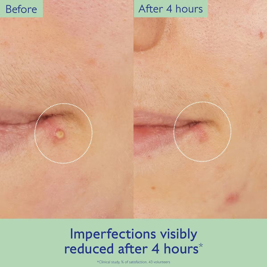 CAUDALÍE VINOPURE SALICYLIC SPOT SOLUTION 15ml