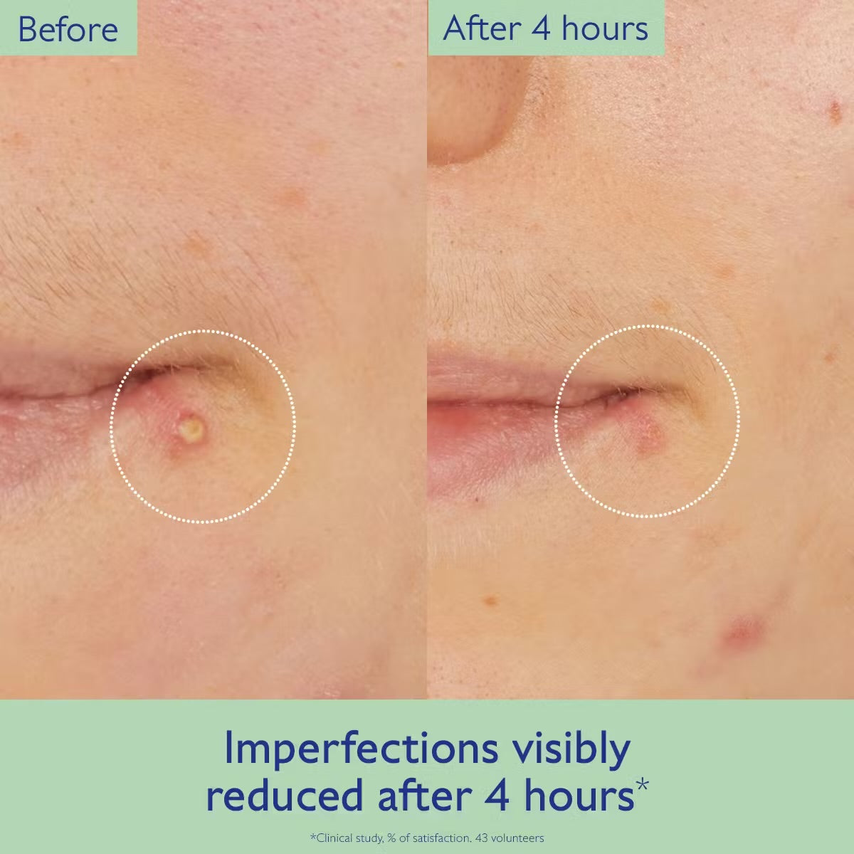 CAUDALÍE VINOPURE SALICYLIC SPOT SOLUTION 15ml