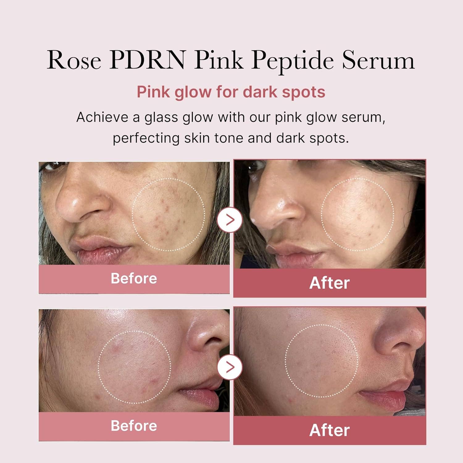 MEDICUBE PDRN Pink Peptide Serum 30ML